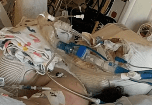 Destini Crane underwent serious burn treatment as a result of the Fire Challenge. (Youtube/6abc Philadelphia)