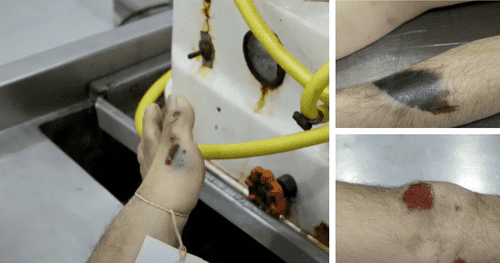 Kimberly Williams revealed images of Elliot Blair's bruises (Youtube/Good Morning America)