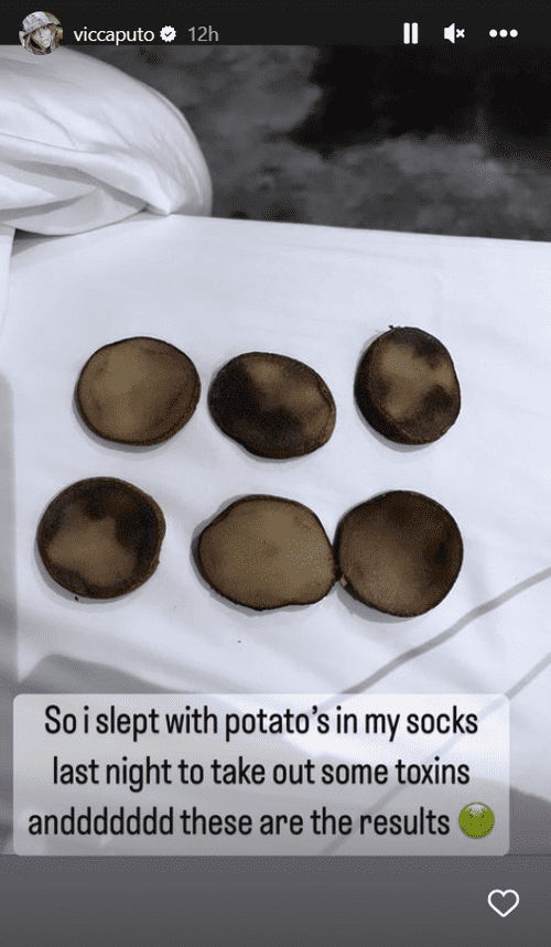 Victoria Caputo tries to remove toxins from her body by placing potatoes in her socks. (Instagram/viccaputo)